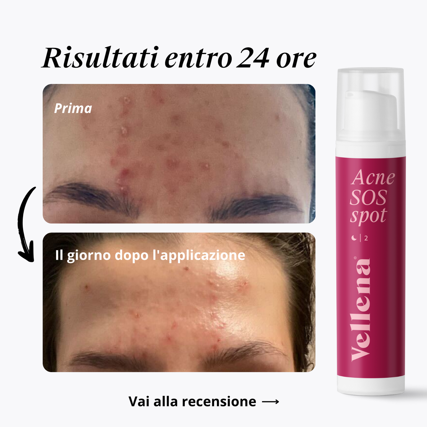Gel per eruzioni cutanee 15ml | Vellena