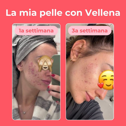 Salute femminile | Capsule 2 PACK | Vellena